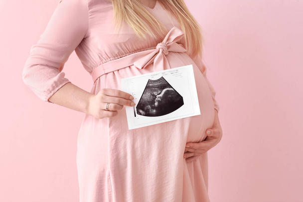 Beautiful pregnant woman with sonogram image on color background - Photo, image