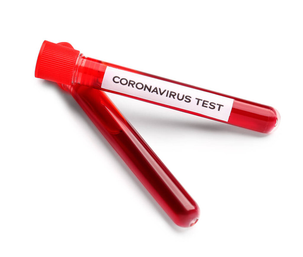 Muestras de sangre en tubos de ensayo con texto CORONAVIRUS sobre fondo blanco
 - Foto, imagen