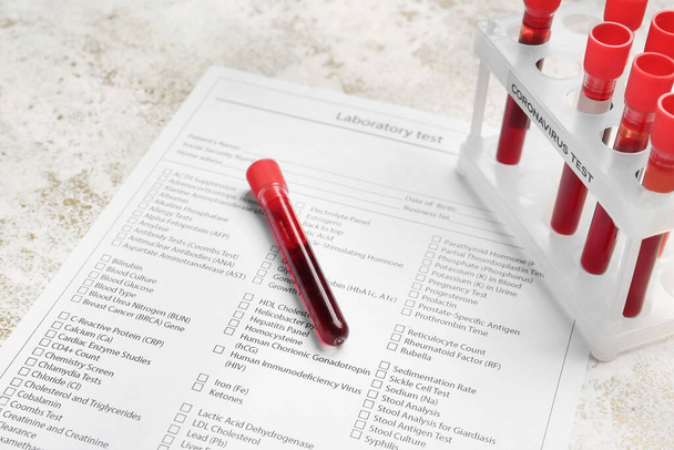 Laboratuvar test formu ve kan örnekleri masada. Koronavirüs salgını kavramı - Fotoğraf, Görsel