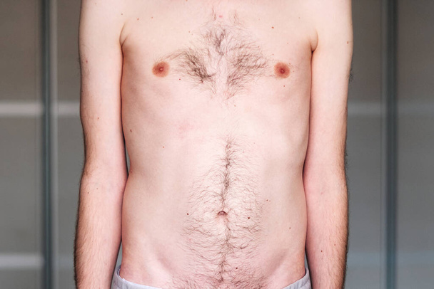 muscular dystrophy of a man with a protrusion of the abdomen - Foto, afbeelding