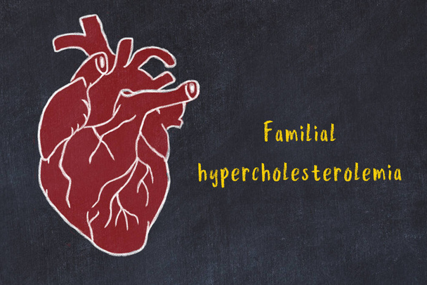 Concept of learning cardiovascular system. Chalk drawing of human heart and inscription Familial hypercholesterolemia - Photo, Image