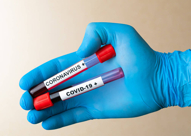 Hand in glove holds tube with positive blood test sample for the Coronavirus COVID-19 disiase, - Photo, Image