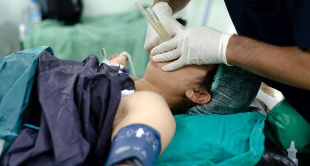 Anesthesist arts brengt endotracheale buis aan op de patiënt. Ondiepe scherptediepte - Foto, afbeelding