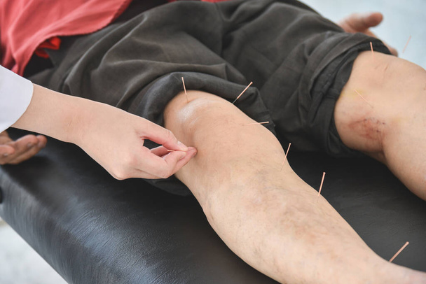 Человек, получающий иглоукалывание на коленях и ногах для облегчения боли, концепция альтернативной медицины. - Фото, изображение