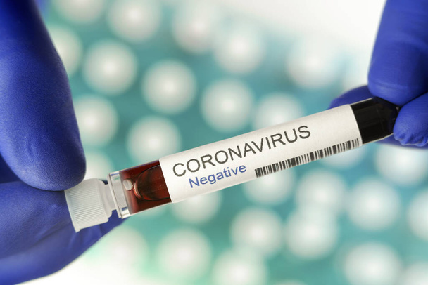 Resultado negativo de las pruebas de coronavirus como símbolo del fin de la pandemia. Muchos tubos de análisis de sangre en un soporte especial en el laboratorio como fondo
. - Foto, Imagen