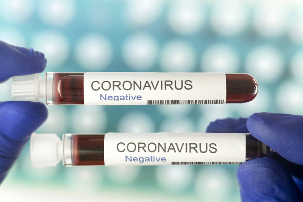 Negatywny wynik dwóch testów na obecność koronawirusów jako symbol zakończenia pandemii. Wiele probówki krwi w specjalnym uchwycie w laboratorium jako tło. - Zdjęcie, obraz