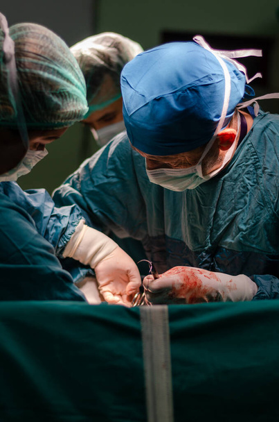 Концентрированный врач и ассистент во время операции по удалению матки в больнице
. - Фото, изображение
