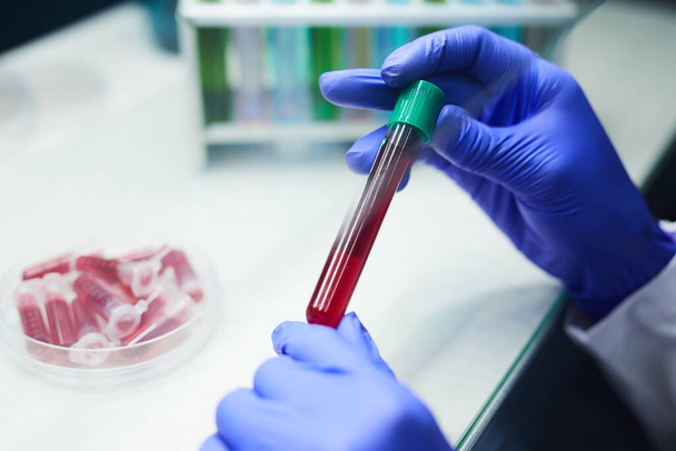 Close-up de cientista irreconhecível segurando tubo de teste com amostra de sangue enquanto trabalhava em pesquisa em laboratório, espaço de cópia
 - Foto, Imagem