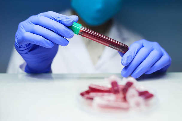 Gros plan d'un scientifique méconnaissable tenant un tube à essai avec un échantillon de sang tout en travaillant sur la recherche en laboratoire, espace de copie
 - Photo, image