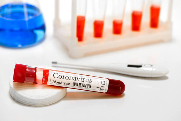 COVID-19 test and laboratory sample of blood testing for diagnosis coronavirus infection and thermometer - Foto, afbeelding