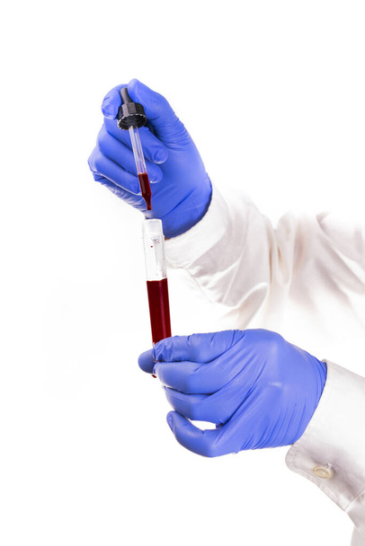 Vue verticale des mains d'un travailleur médical avec des gants de protection, tenant une éprouvette et prélevant un échantillon de sang avec une pipette, sur un fond blanc, avec un copyspace. Test du coronavirus. Une couronne
 . - Photo, image