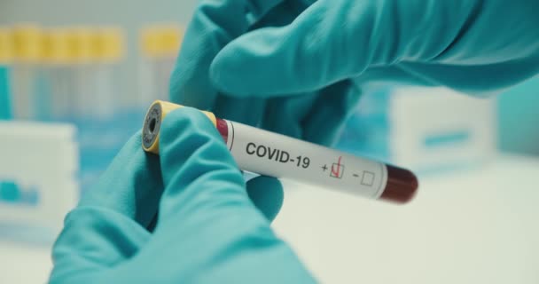 Close-up scientist hands gloves laboratory test tube protection coronavirus positive background - Video, Çekim