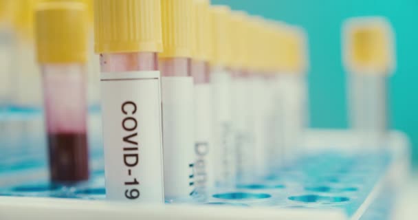 Close-up scientist laboratory test tube protection coronavirus positive background - Imágenes, Vídeo