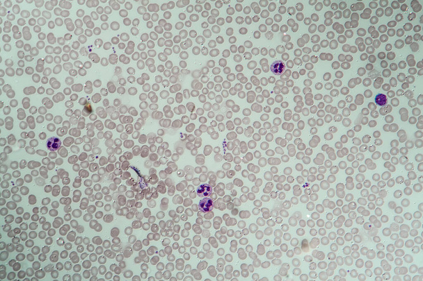 赤と白の血液細胞400x - 写真・画像