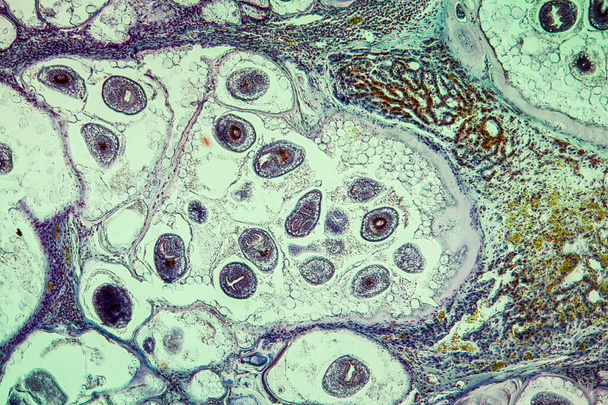 Worms in infected liver 100x - Photo, Image