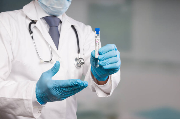 lékař drží zkumavku po analýze viru s pozitivními značkami výsledků před laboratoří   - Fotografie, Obrázek