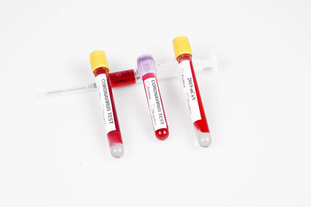 Syringe and filled blood tubes on white background - Photo, Image