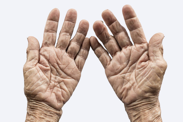 mãos de mulher velha em um fundo branco
 - Foto, Imagem