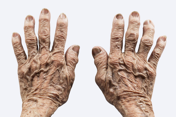manos de la anciana sobre un fondo blanco
 - Foto, imagen