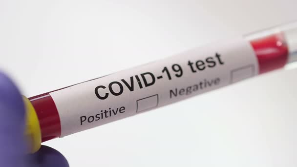 Coronavirus, prueba de sangre COVID-19, brote macro de primer plano. Coronavirus NCOV prueba resultados negativos positivos. Imágenes médicas. Marcando el concepto de análisis de sangre. SARS, MERS, FLU. Dispara a cámara roja cámara lenta
. - Imágenes, Vídeo