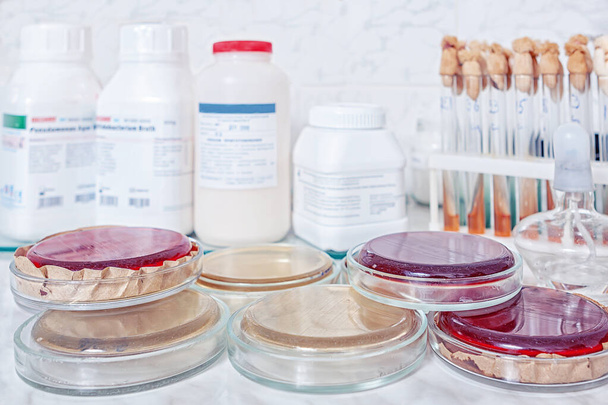біолабораторія, стіл з колонією бактерій в посуді Петрі
 - Фото, зображення