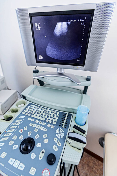Ultrazvukové přístroje, oddělení ultrazvukové diagnostiky - Fotografie, Obrázek