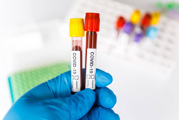 COVID-19 test tube and laboratory sample of blood testing for diagnosis new Corona virus infection(novel corona virus disease from hospital background. Pandemic infectious concept - Foto, Imagem