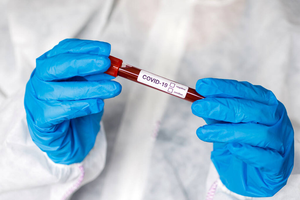 COVID-19 test tube and laboratory sample of blood testing for diagnosis new Corona virus infection(novel corona virus disease from hospital background. Pandemic infectious concept - Fotó, kép