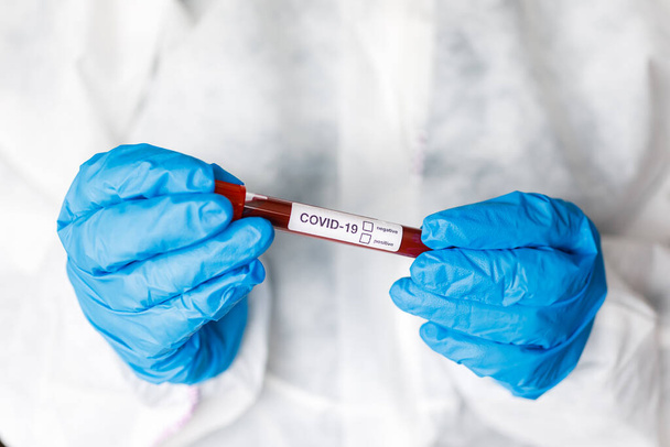 Covid 19 Коронавирус инфицированных крови в трубке в руке ученого доктора биологической защиты одежды в лаборатории коронавируса исследований. Исследования коронавируса Ковид-19
. - Фото, изображение
