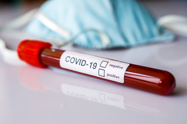 Coronavirus 2019 nCoV positive or negative blood test. Focus on result. - Foto, afbeelding