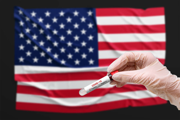 A doctor holds a test tube with a positive blood test for coronavirus in front of the USA, America flag. Covid-19 epidemic, infection, pandemic, pneumonia. - Foto, immagini