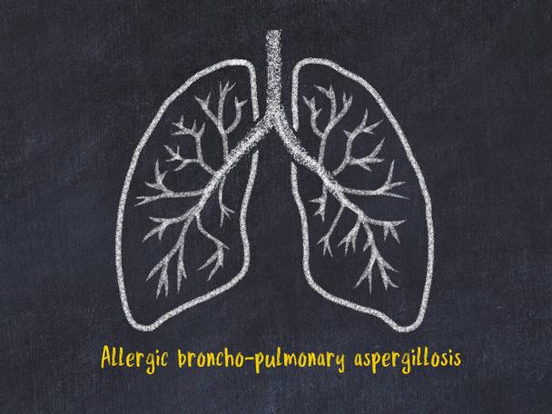 Концепція вивчення захворювань легень. Крейдовий малюнок легенів з написом
 - Фото, зображення