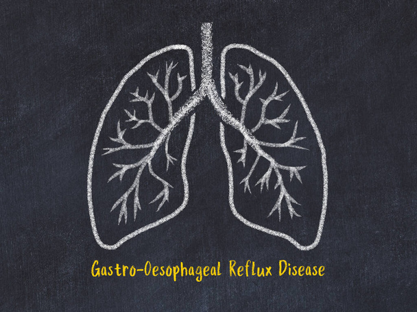 Concepto de aprendizaje de enfermedades pulmonares. Dibujo de tiza de pulmones con inscripción
 - Foto, Imagen