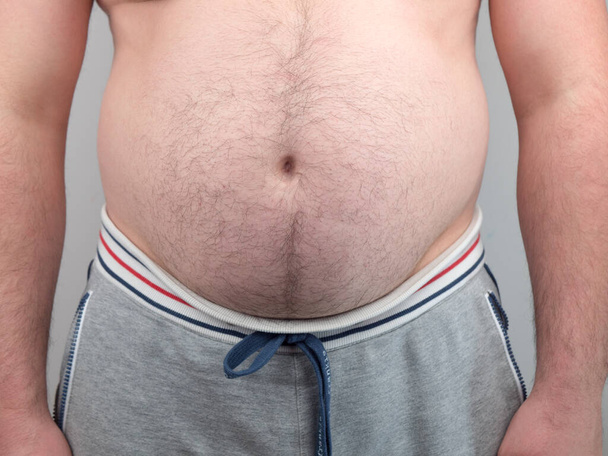 Чоловіки жиру в тілі з рукою, що тримає надмірний жир живота. Наслідки ізоляції коронавірусу під час карантину
. - Фото, зображення