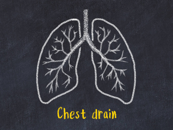 Akciğer hastalıklarını öğrenme kavramı. Ciğerlerin yazı ile çizilmesi - Fotoğraf, Görsel
