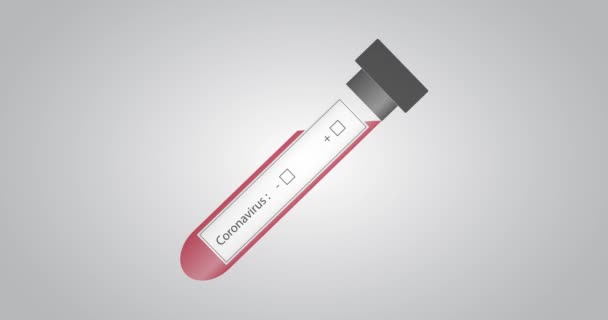 Negativní koronavirový krevní test. - Záběry, video
