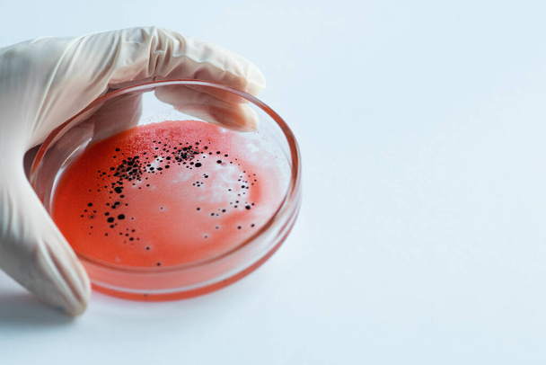 Research of viruses and bacteria, researcher holds a Petri dish with a sample. - Foto, immagini