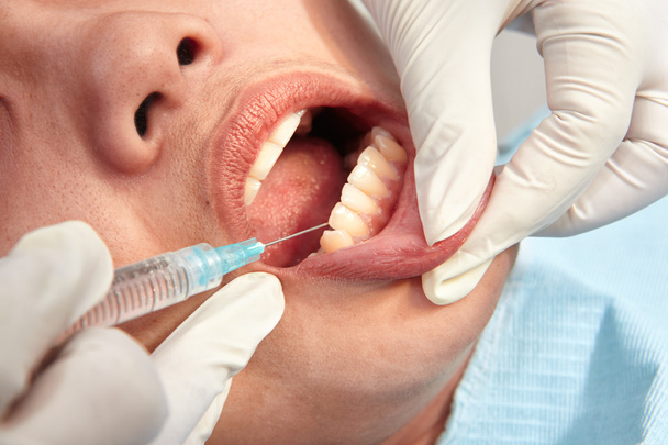 Close up teeth examination - Valokuva, kuva