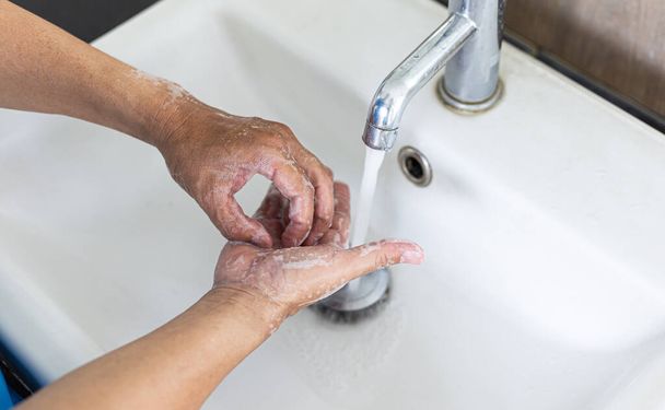 L'homme se lave les mains dans un évier désinfectant le virus du côlon pour l'assainissement et réduisant la propagation de la COVID-19 dans le monde entier, Hygiène, concept d'assainissement. - Photo, image
