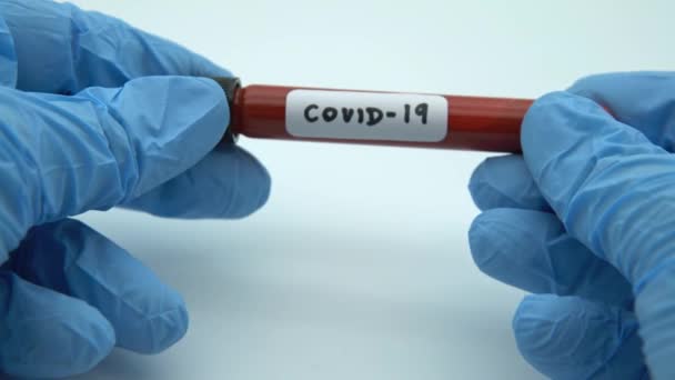 4K, θετική δοκιμή COVID-19 και εργαστηριακό δείγμα της εξέτασης αίματος για τη διάγνωση της νέας λοίμωξης από τον ιό Corona. Ασθένεια 2019 από Wuhan. Πανδημία μολυσματική έννοια-Dan - Πλάνα, βίντεο