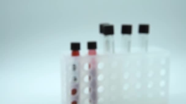 4K, Test tube with infected blood sample for COVID-19, novel coronavirus found in Wuhan, China. Scientist with blue gloves for protection. Vaccine research for the virus 2019-nCoV-Dan - Filmati, video