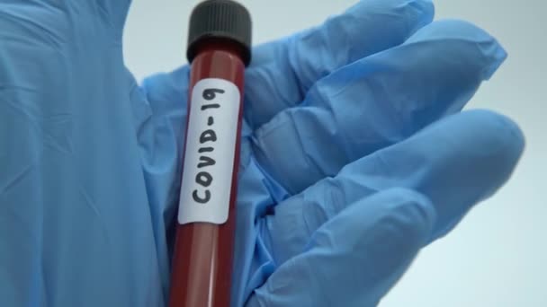 4K, Coronavirus Covid 19 μολυσμένο δείγμα αίματος σε σωλήνα. Έρευνα εμβολίου του ιού 2019-nCoV στο εργαστήριο. Ασθένεια 2019 από Wuhan. Πανδημία μολυσματική έννοια-Dan - Πλάνα, βίντεο