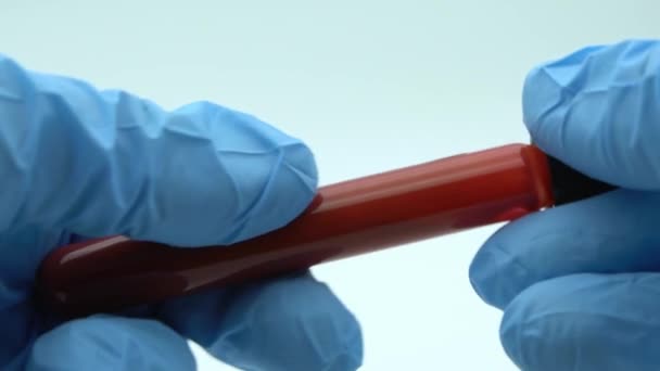 Αργή κίνηση της θετικής δοκιμής COVID-19 και εργαστηριακό δείγμα των εξετάσεων αίματος για τη διάγνωση της νέας λοίμωξης από τον ιό Corona. Ασθένεια 2019 από Wuhan. Πανδημία μολυσματική έννοια-Dan - Πλάνα, βίντεο