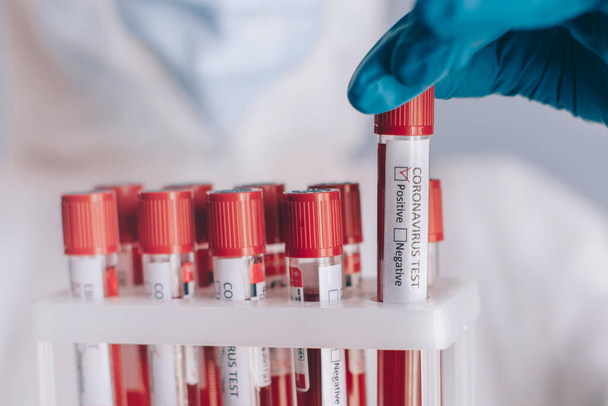 Test tube with blood for analysis on coronavirus. - Foto, Imagem