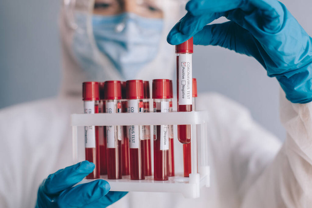 Test tube with a blood sample for testing coronavirus. - Фото, изображение