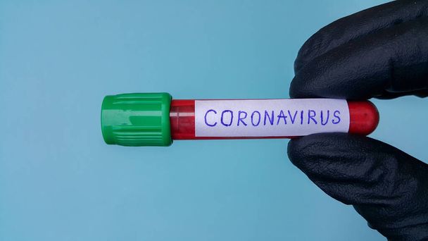 Tubos de vacío Covid-19 del Coronavirus para el trabajo médico con muestras de sangre en el laboratorio. Prueba del Coronavirus. La mano de un médico en un guante médico de goma negra. Espacio para texto sobre fondo azul
. - Foto, Imagen