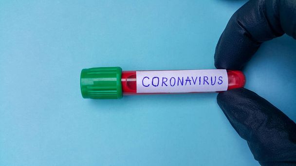 Coronavirus Covid-19 Vakuumröhren für die medizinische Arbeit mit Blutproben im Labor. Coronavirus-Test. Die Hand eines Arztes in einem schwarzen medizinischen Gummihandschuh. Platz für Text auf blauem Hintergrund. - Foto, Bild