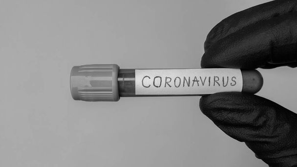 Tubos de vacío Covid-19 del Coronavirus para el trabajo médico con muestras de sangre en el laboratorio. Prueba del Coronavirus. La mano de un médico en un guante médico de goma negra. Foto en blanco y negro. Espacio para texto
.  - Foto, imagen
