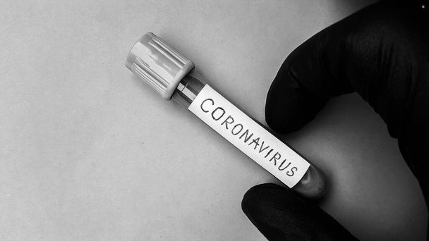 Tubi a vuoto Covid-19 di Coronavirus per lavoro medico con i campioni di sangue nel laboratorio. Test di Coronavirus. La mano di un medico in un guanto di gomma nera. Foto in bianco e nero. Spazio per testo
.  - Foto, immagini