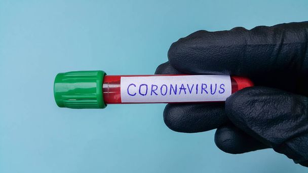 Coronavirus Covid-19 Vakuumröhren für die medizinische Arbeit mit Blutproben im Labor. Coronavirus-Test. Die Hand eines Arztes in einem schwarzen medizinischen Gummihandschuh. Platz für Text auf blauem Hintergrund. - Foto, Bild